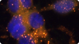 Polyneuropathy <br>(PNP)